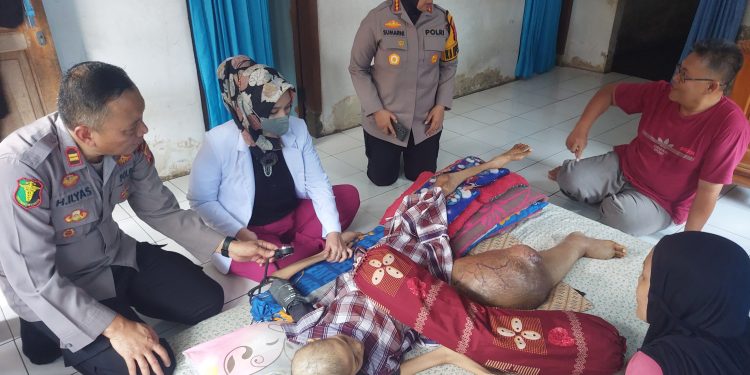 Perhatian Kapolresta Cirebon Terhadap Remaja Putri yang Terjangkit Osteo Sarkoma