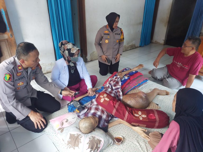 Perhatian Kapolresta Cirebon Terhadap Remaja Putri yang Terjangkit Osteo Sarkoma